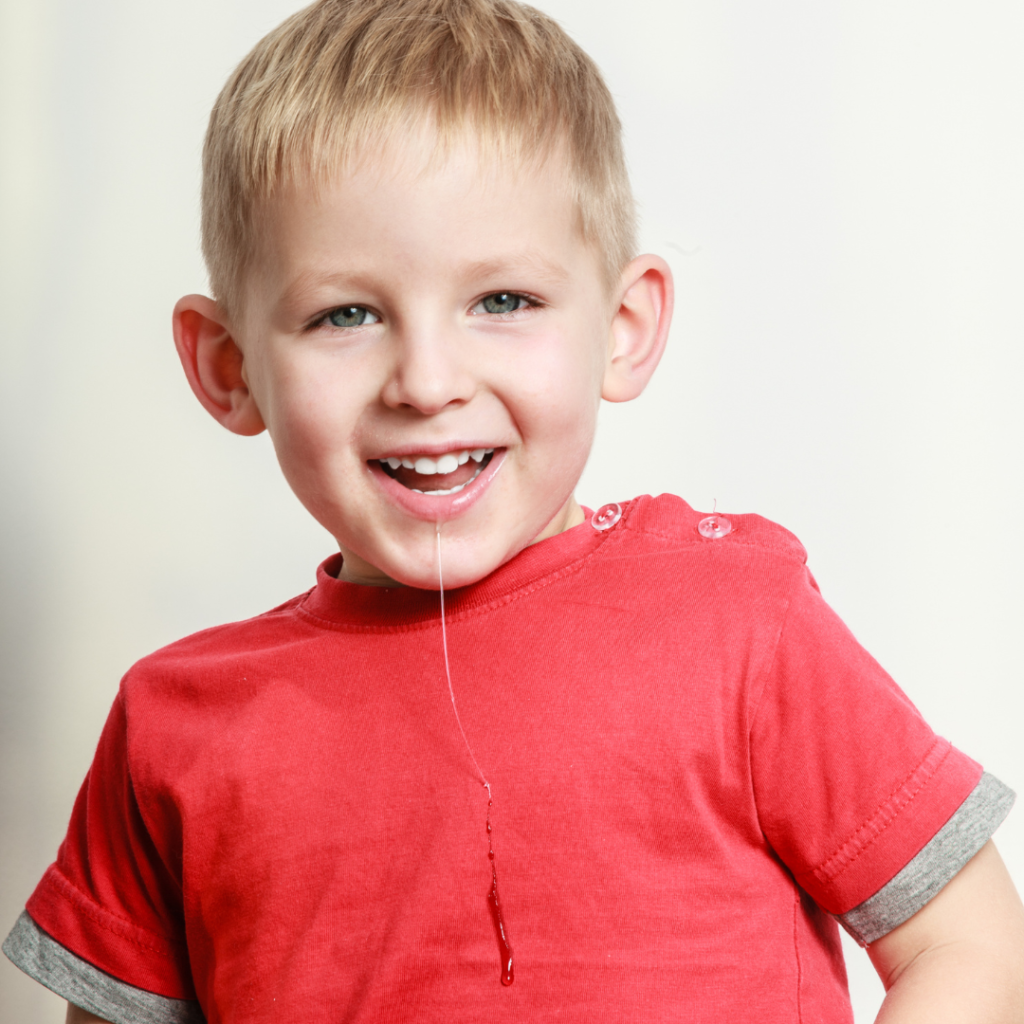 tongue tie support for child